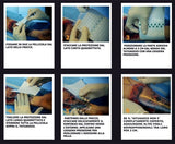 DERMALIZE FILM, 5pcs